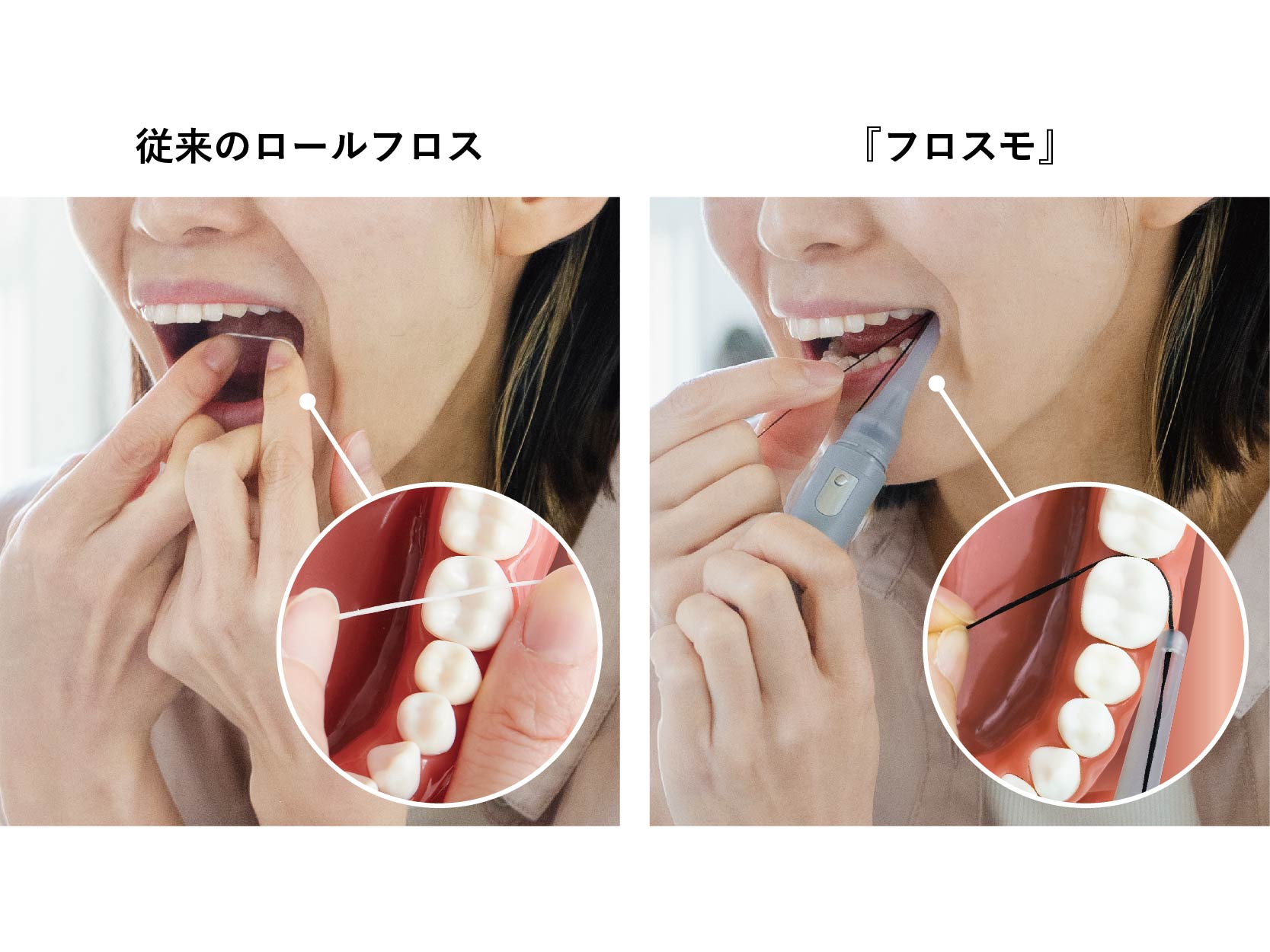 フロス ロール タイプ